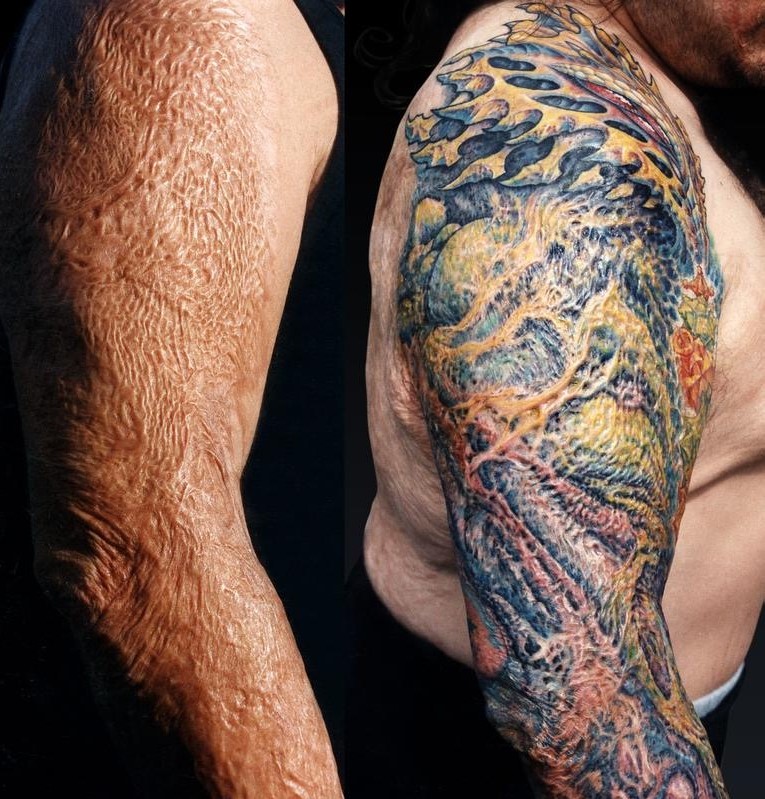Ганвест до татуировок фото и после