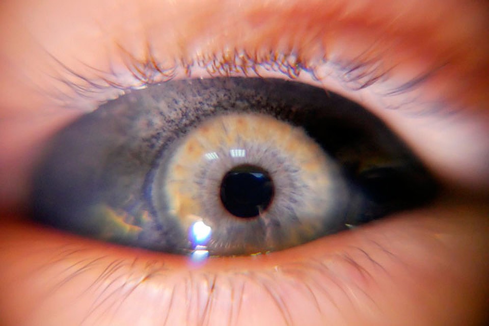 Заливать глаза не больно, уверяет Илья Фото: Личный архив